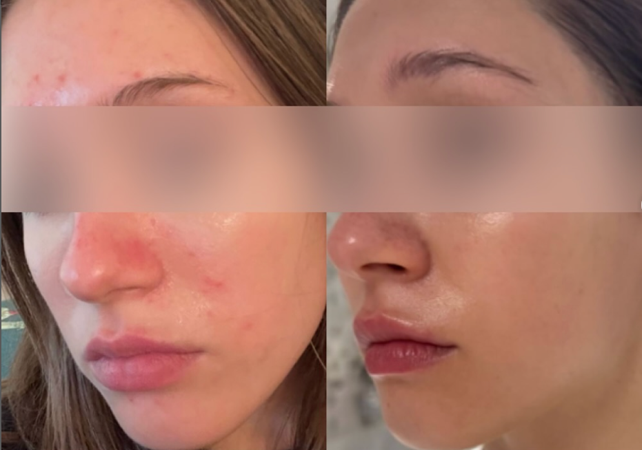 SkinSOS Niacinamide Serum